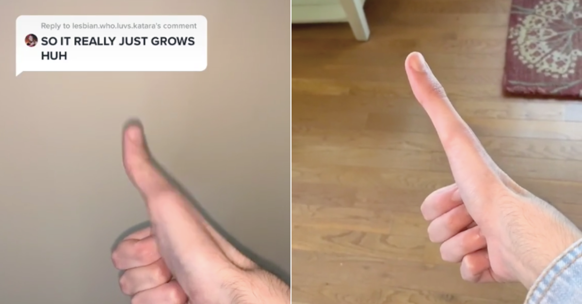 Man becomes TikTok sensation for ‘growing’ his thumbs