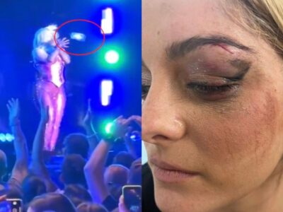 Bebe Rexha gets three stitches on the face after an audience member throws a phone at her during her concert