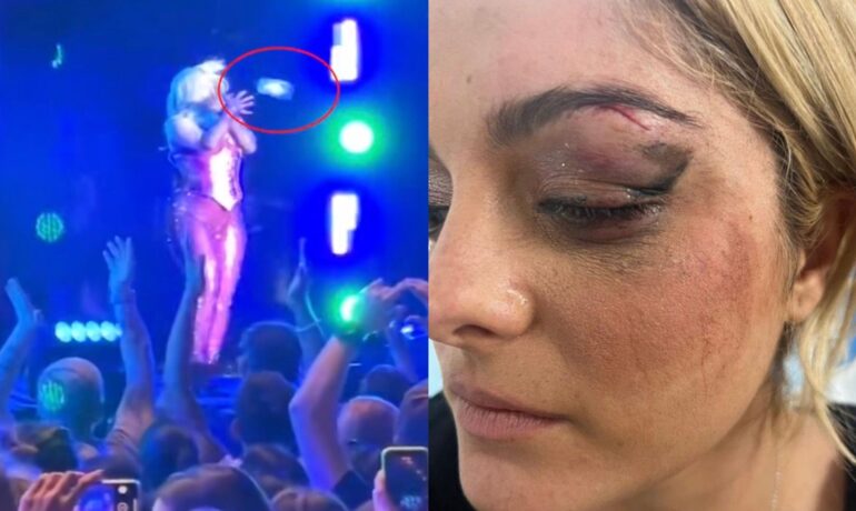 Man arrested after throwing phone at Bebe Rexha during her concert pop inqpop