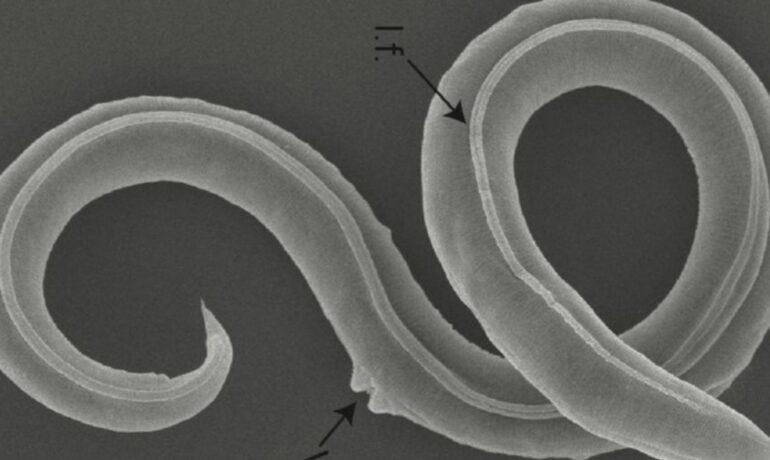 Scientists reawaken a 46,000-year-old roundworm from Siberian permafrost, and it started having babies pop inqpop
