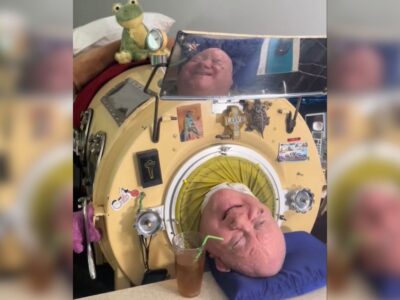 Longest surviving iron lung patient Paul Alexander dies, leaves inspiring legacy