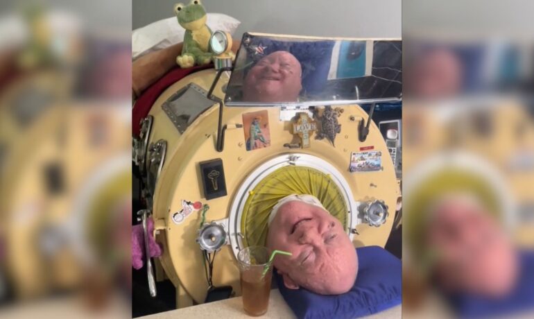 Longest-surviving iron lung patient Paul Alexander dies, leaves inspiring legacy pop inqpop