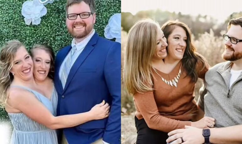 Conjoined twins Abby and Brittany Hensel clap back at haters after marriage news goes viral (1)