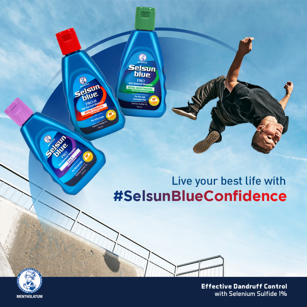 Selsun Blue for effective dandruff control